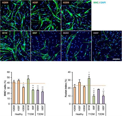 Myogenetic Oligodeoxynucleotide (myoDN) Recovers the Differentiation of Skeletal Muscle Myoblasts Deteriorated by Diabetes Mellitus